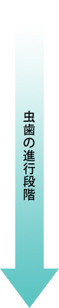 虫歯の進行段階
