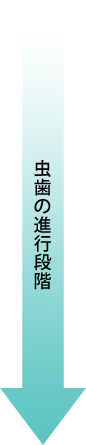 虫歯の進行段階